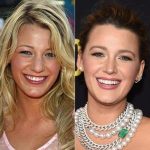 Hollywood stars are ruining their looks and damaging their teeth